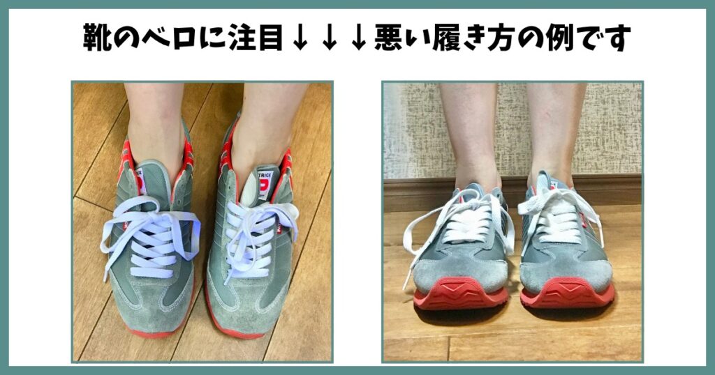 靴のベロがズレてしまっている間違った履き方。足トラブルの原因になりやすい
